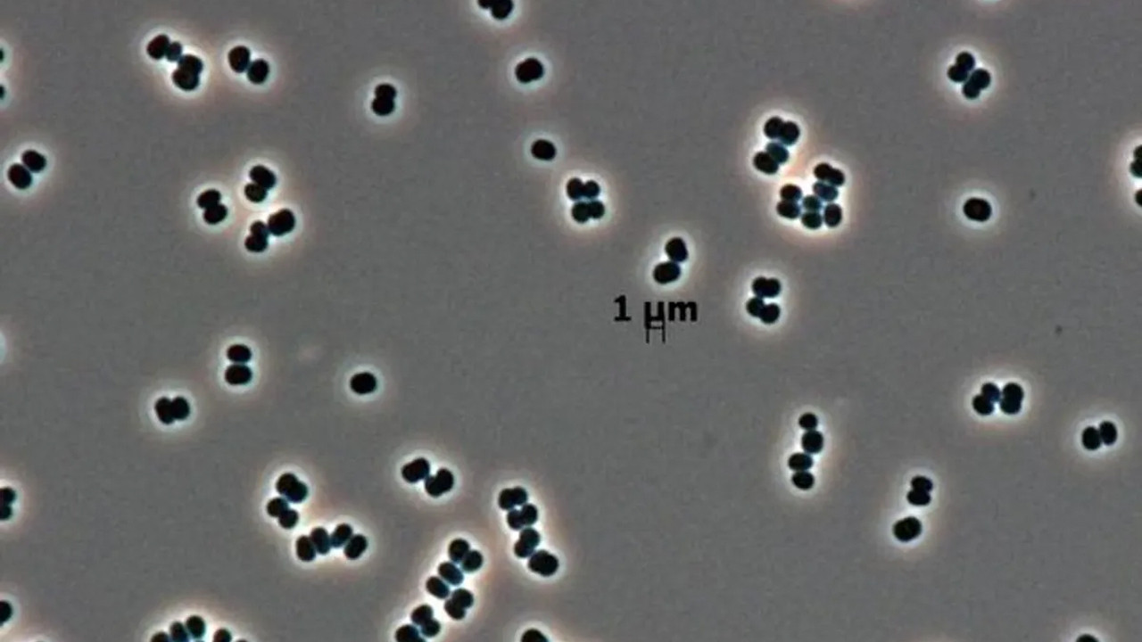 olu taklidi yapan super bakteriler uzayi bile tehdit ediyor xJ1VQy1s.jpg